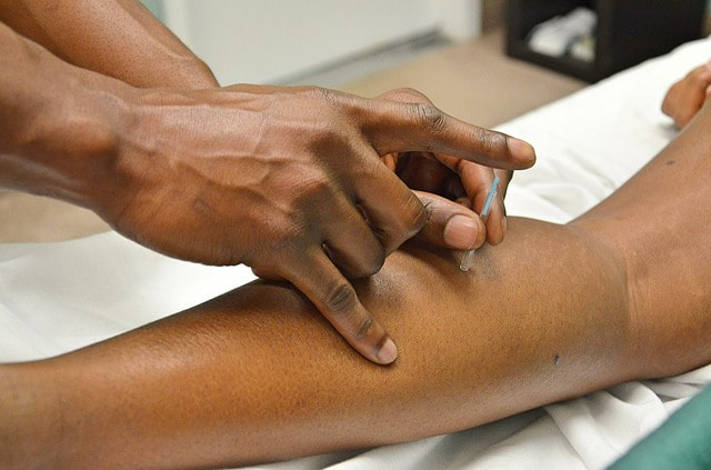 Person receiving dry needling treatment